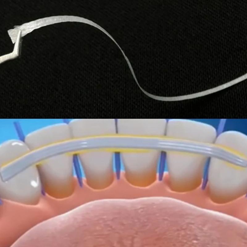 7Pcs/Boxed Dental Flexible Fiber Strip Tooth Fixation Strips Light Cure Bonding Retainers Dental Materials