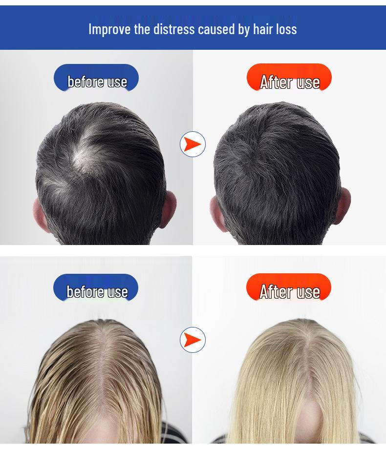 Infrared Red Light Therapy Hat for Hair Growth with Three-Level Pulse Adjustment