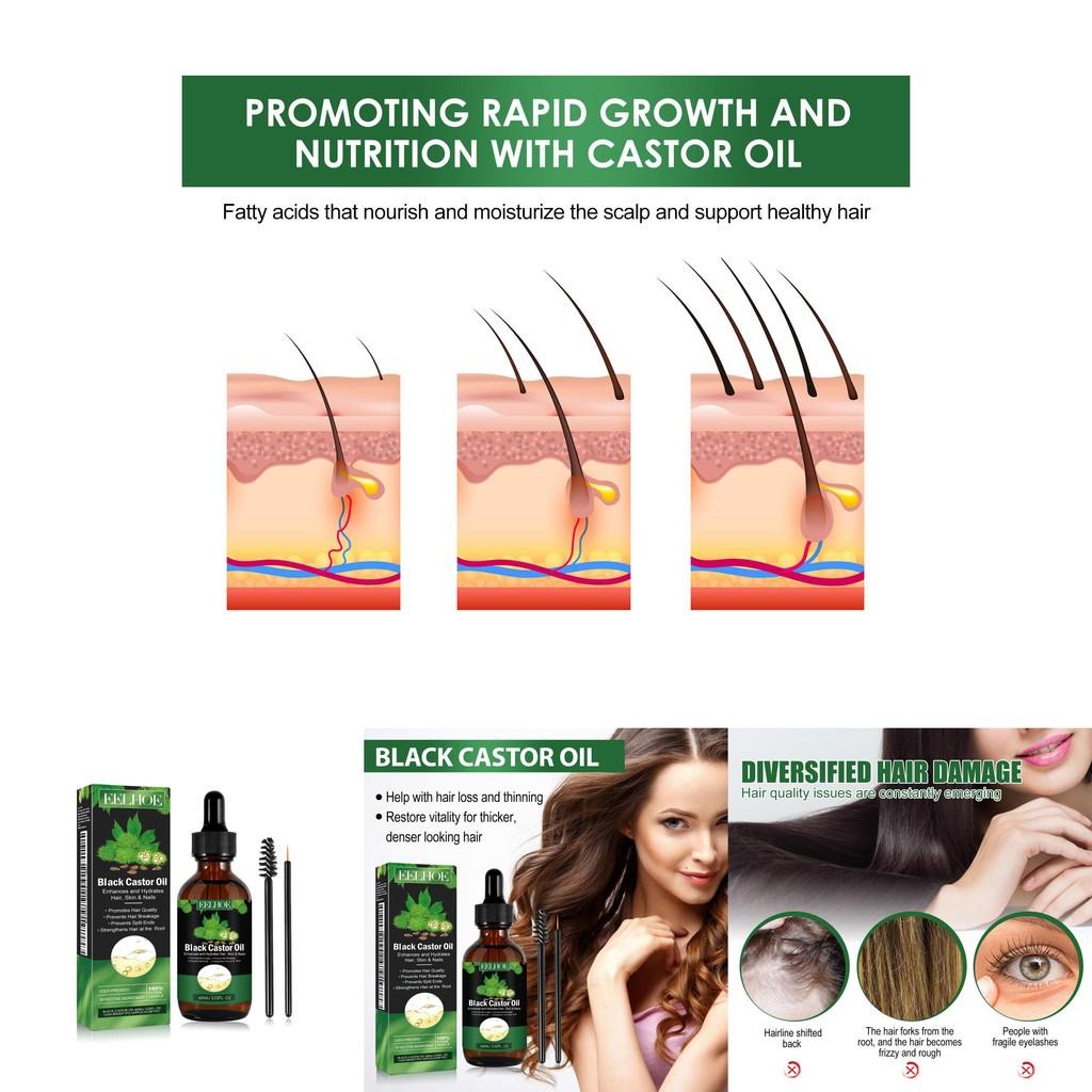 Eelhoe Castor Oil Hair Growth Serum Rich Nourishing Scalp Massage Treatment 60ml Set