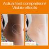 Underarm Whitening Cream, Gongpei Light, Dark, Smooth And Even Skin Body Care Cream.