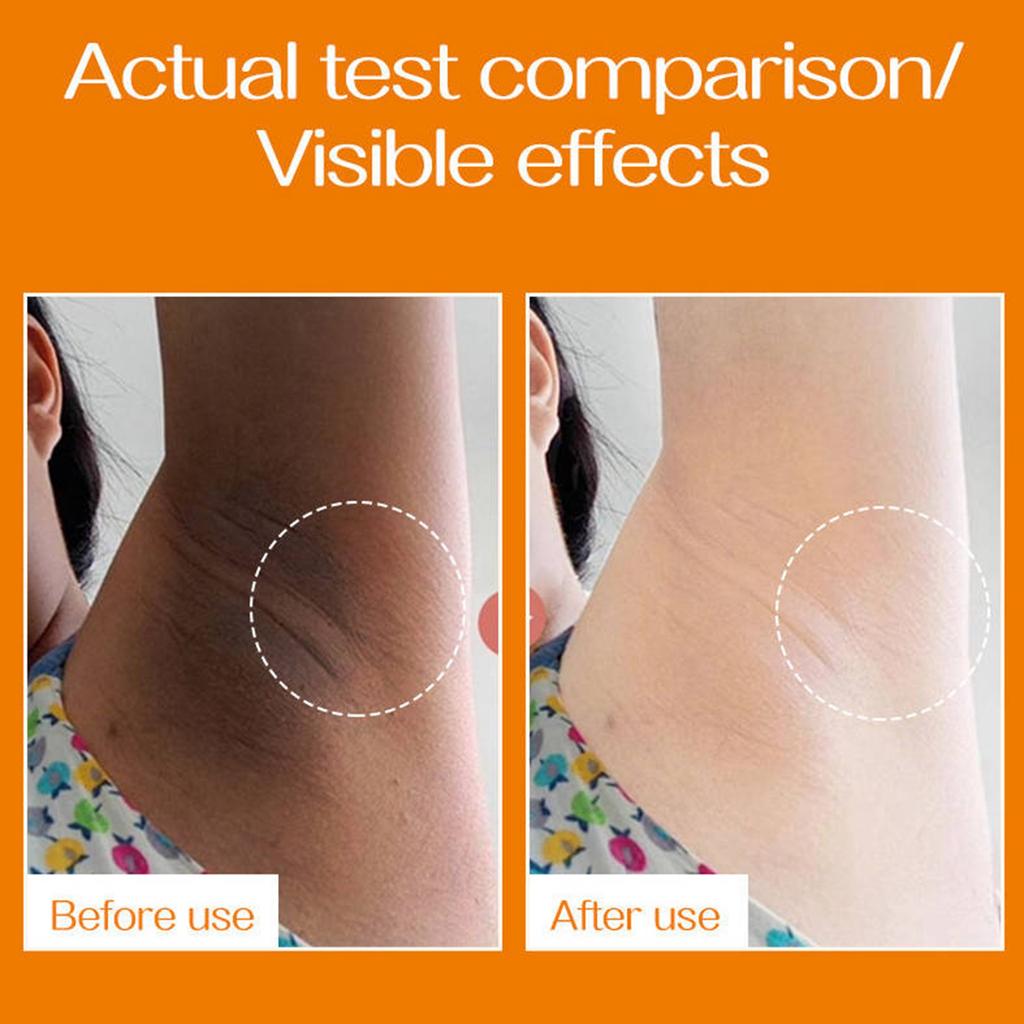 Underarm Whitening Cream, Gongpei Light, Dark, Smooth And Even Skin Body Care Cream.