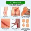 Silicone Foam Dressing Waterproof Soft Skin Friendly Sacrum Bandages Adhesive Wound Care Patch