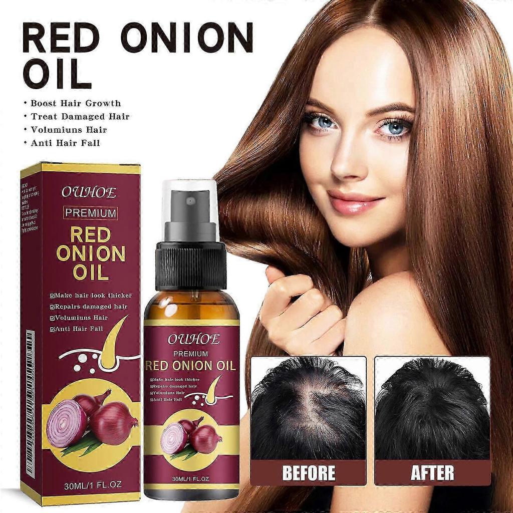 2025 Onion Hair Growth Essential Oil With Onion & Redensyl Onion Essential Oil for Hair Loss Treatment 30ml