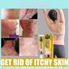 Premium Skin Healing Cream For Tinea Versicolor Itch Relief And Skin Restoration