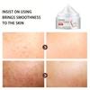 Whitening Essence Cream, Even Facial Skin, Anti-oxidation Anti-aging, Moisturizing Acne Cream