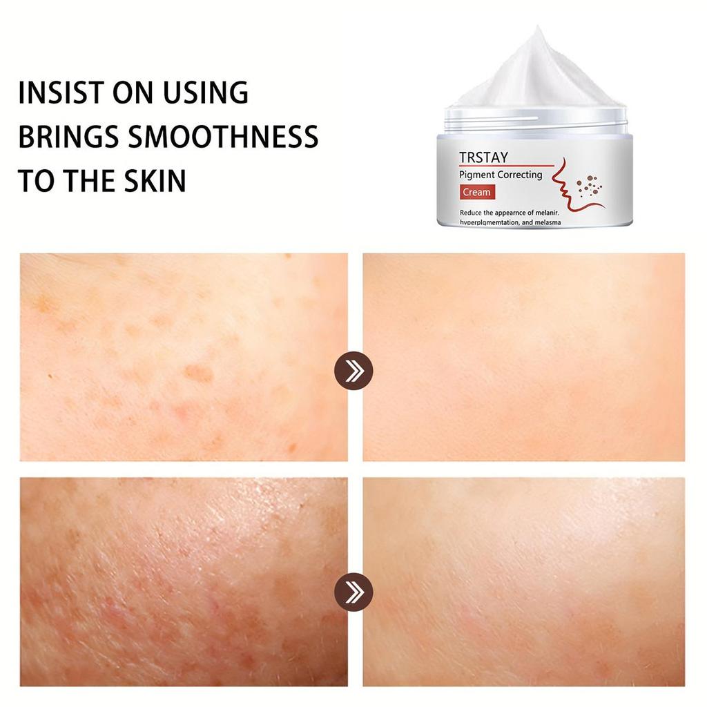 Whitening Essence Cream, Even Facial Skin, Anti-oxidation Anti-aging, Moisturizing Acne Cream