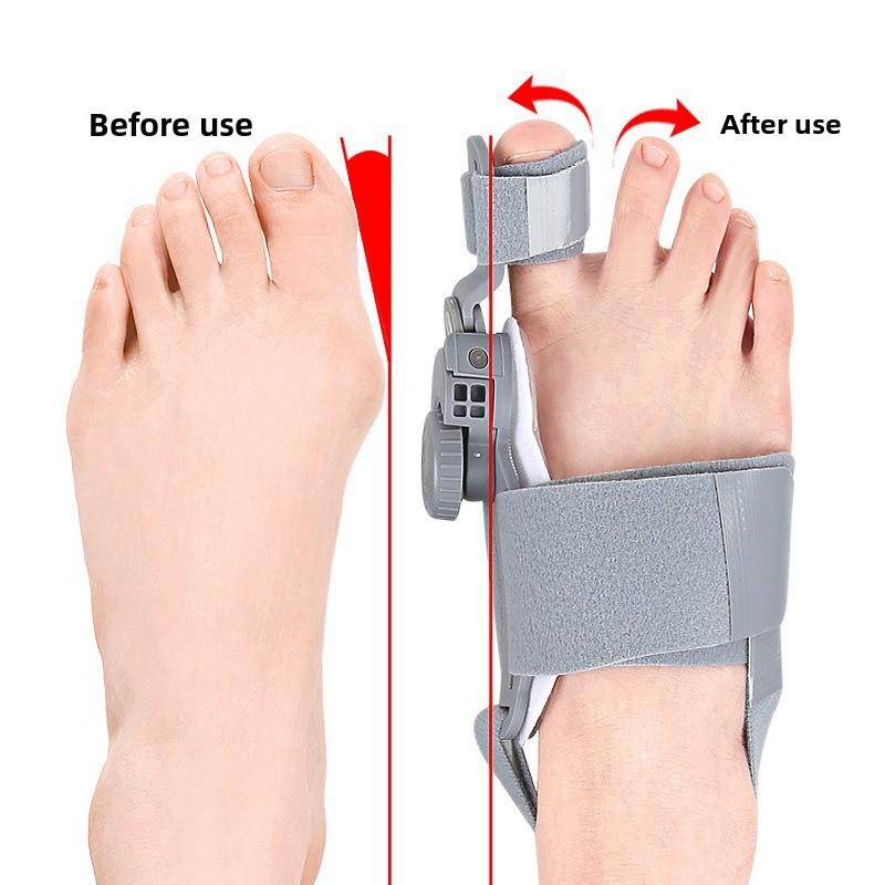 Bunion Corrector Unisex Foot Hallux Valgus Braces Rotatable Toe Separator Straightener Adjustable Pedicure Finger Toe Corrector