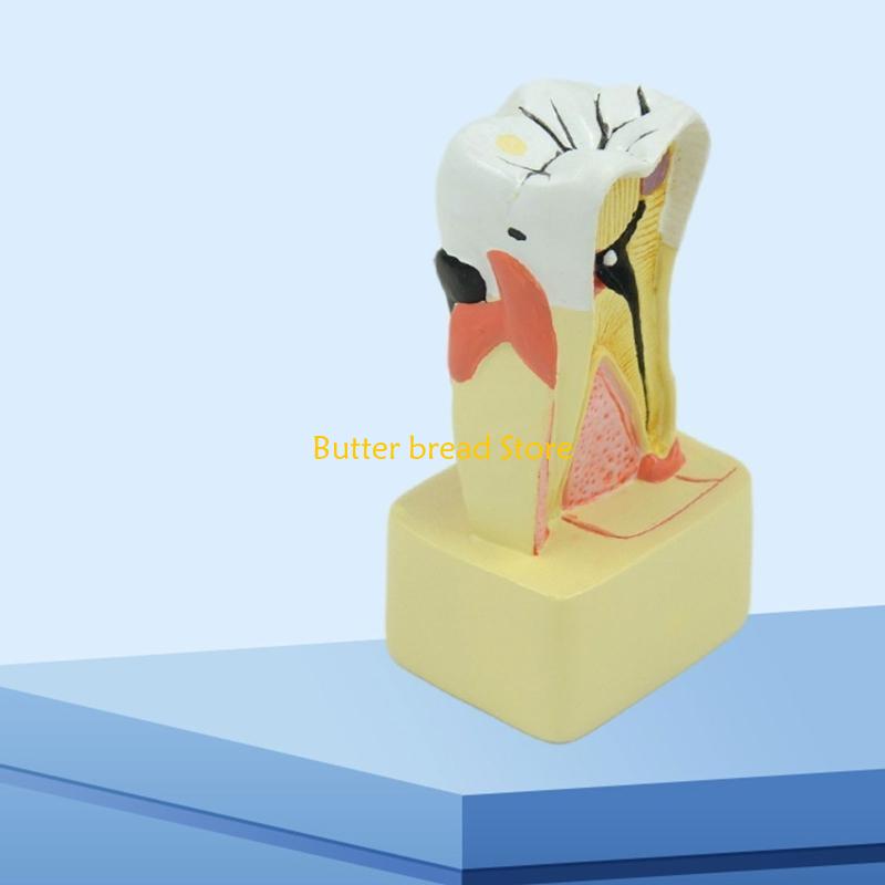 W89C Dental Teeth Model Periodontal Mode Studying Tooth Pathology Module for Medical Science Dentist Dentistry China Mainland