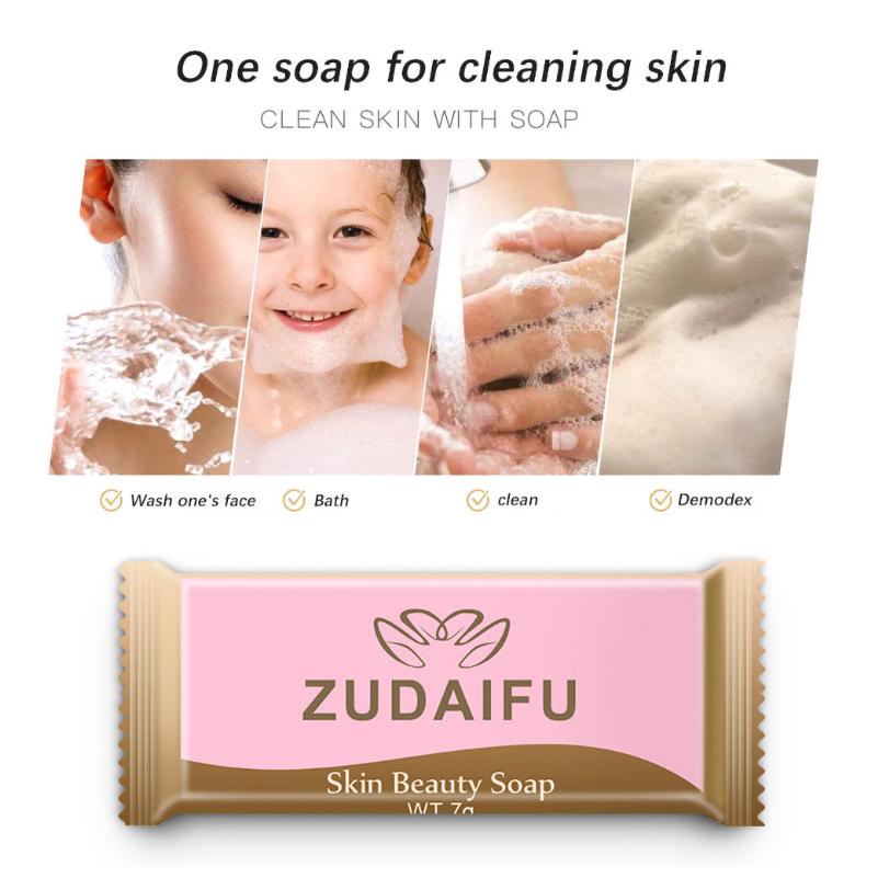 Shanghai Sulfur Soap 2-Pack - 85g Bars For Acne, Itchy Skin, Fungus & Body Care