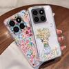 Girl Flowers Pattern Case For Xiaomi Redmi Note 15 Pro 4G Funda Redmi Note 14 13 Pro 5G Clear TPU Silicone Soft Cover