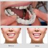 Cosmetic Teeth: 1 Unit Gel Denture Cover - Natural Looking Smile Makeover Teeth Whitening Set for Oral Care Confidence