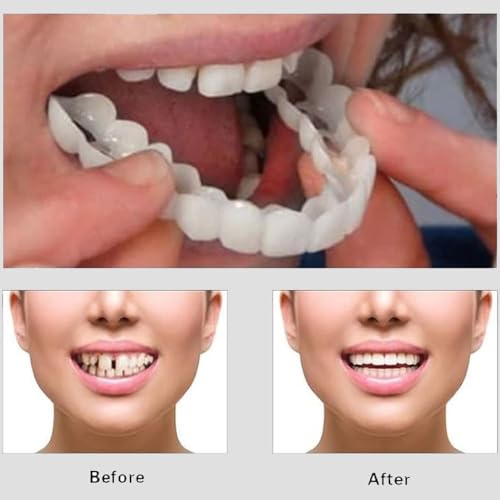 Cosmetic Teeth: 1 Unit Gel Denture Cover - Natural Looking Smile Makeover Teeth Whitening Set for Oral Care Confidence