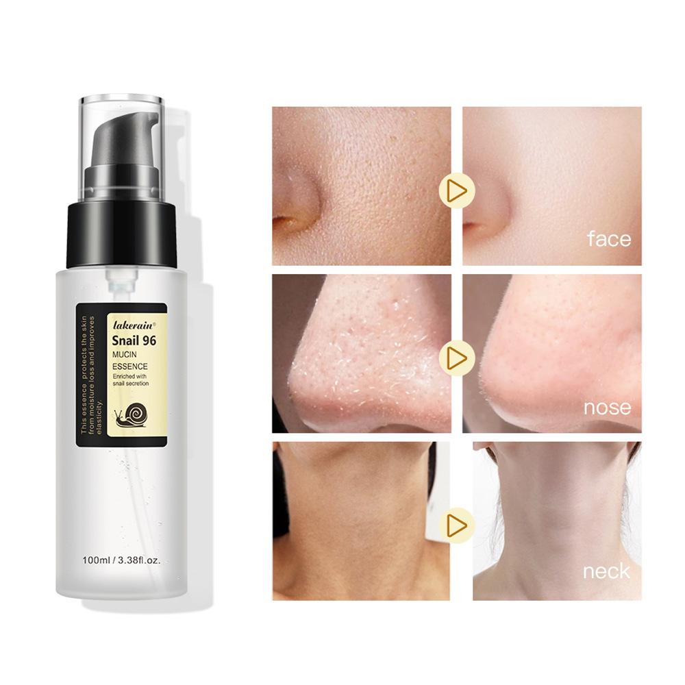 Snail  Serum 96% Power Repairing Essence Lift Firm Anti-aging Fade Fine Lines Acne Treatment Facial Sensitive Whitening 100ml
