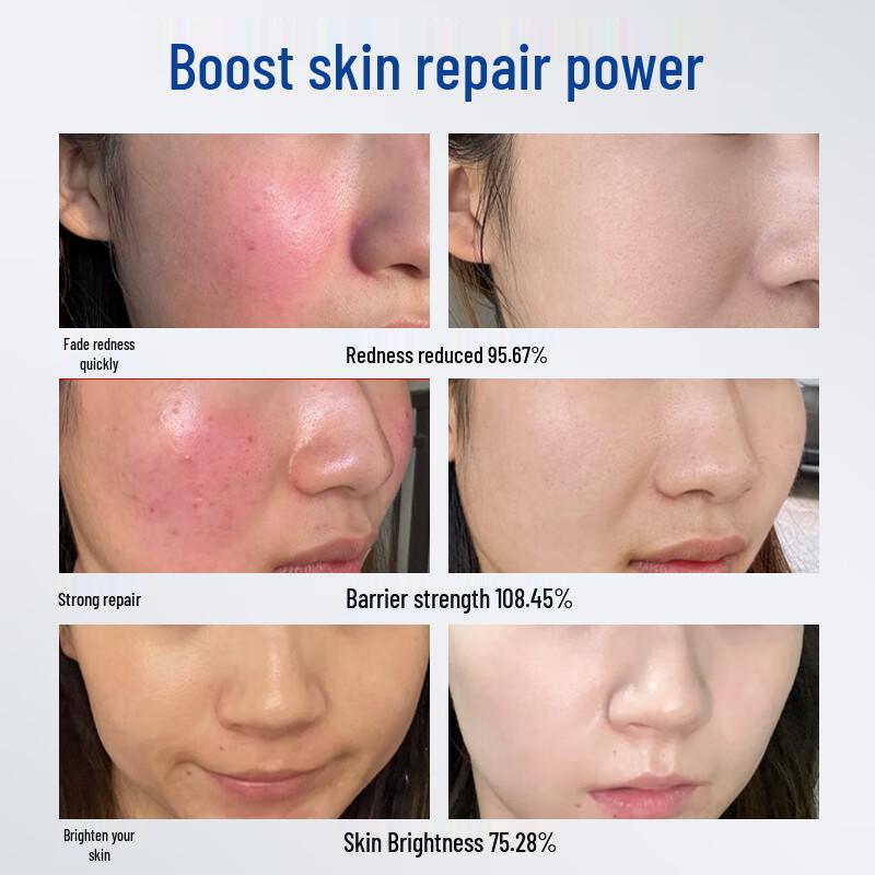 Naseki Oligopeptide Freeze-Dried Skin Repair Kit