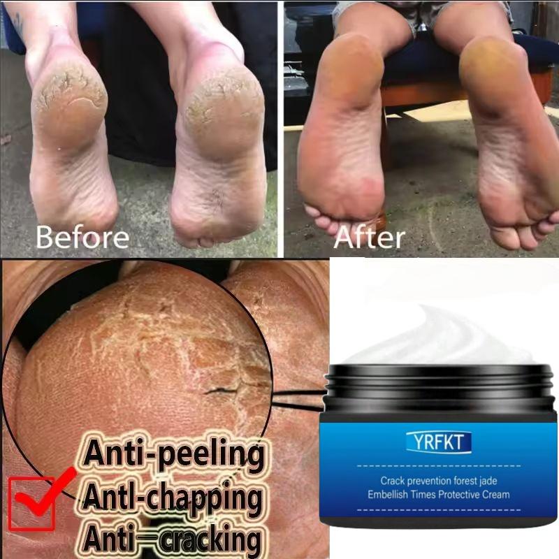 Powerful Foot Moisturizing Cream - Deeply moisturizes, prevents cracking and repairs the feet and heels, making them smooth, soft, and silky