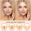 128Pcs Hydrocolloid Salicylic Acne Patches Large Capacity Transparent Invisible Skin Care Stickers for Acne Removal