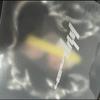 Audio ja video – Muusikaalbumid