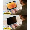 F FORITO 2-Pack 360° Laptop Privacy Screen Compatible with 2024-2021 MacBook Pro 14 Inch (M1, M2, M3, M4, Pro, Max), Eye Protection and Anti Peeping