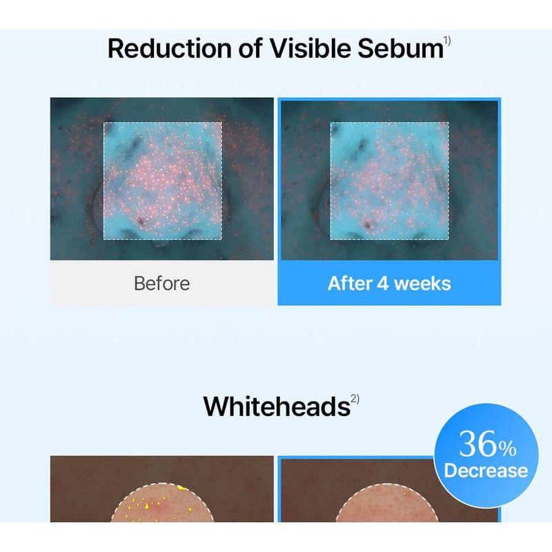 SKIN 1004 - Madagascar Centella Light Cleansing Oil