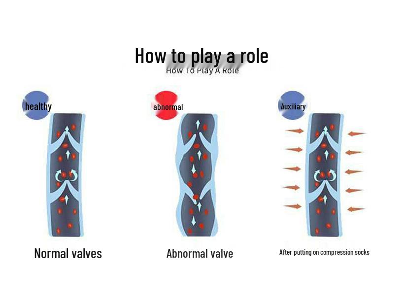 Manchons de mollet de compression unisexes - Pression transfrontalière, Soutien de deuxième niveau