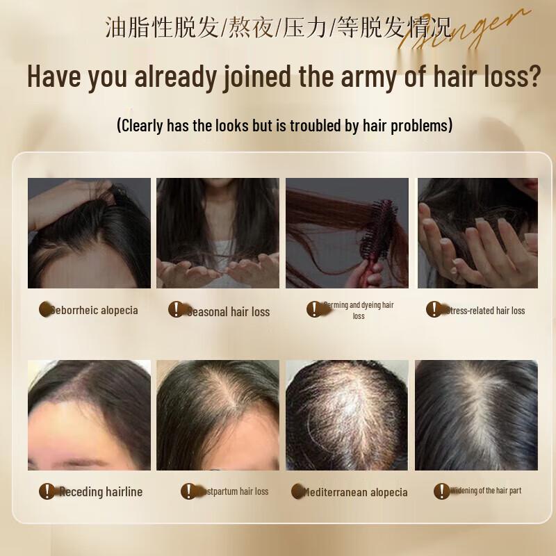 Tongrentang Anti-Hair Loss & Hair Growth Ginger Shampoo