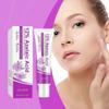 2025 Latest Model  Azelaic Acid Anti-Acne Repair Cream To Reduce Acne And Improve Redness