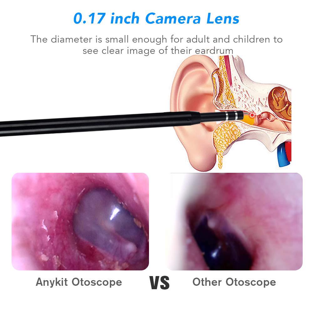 Smart Visual Ear Cleaner Ear Stick Endoscope Earpick Camera Otoscope Ear Cleaner Ear Wax Remover Ear Picker Ear Stick beleza PC