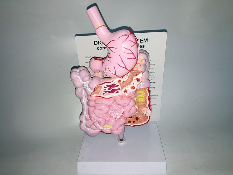 Human Digestive System Model: Large Intestine, Rectum, Duodenum, Stomach & Intestines Anatomical Structure