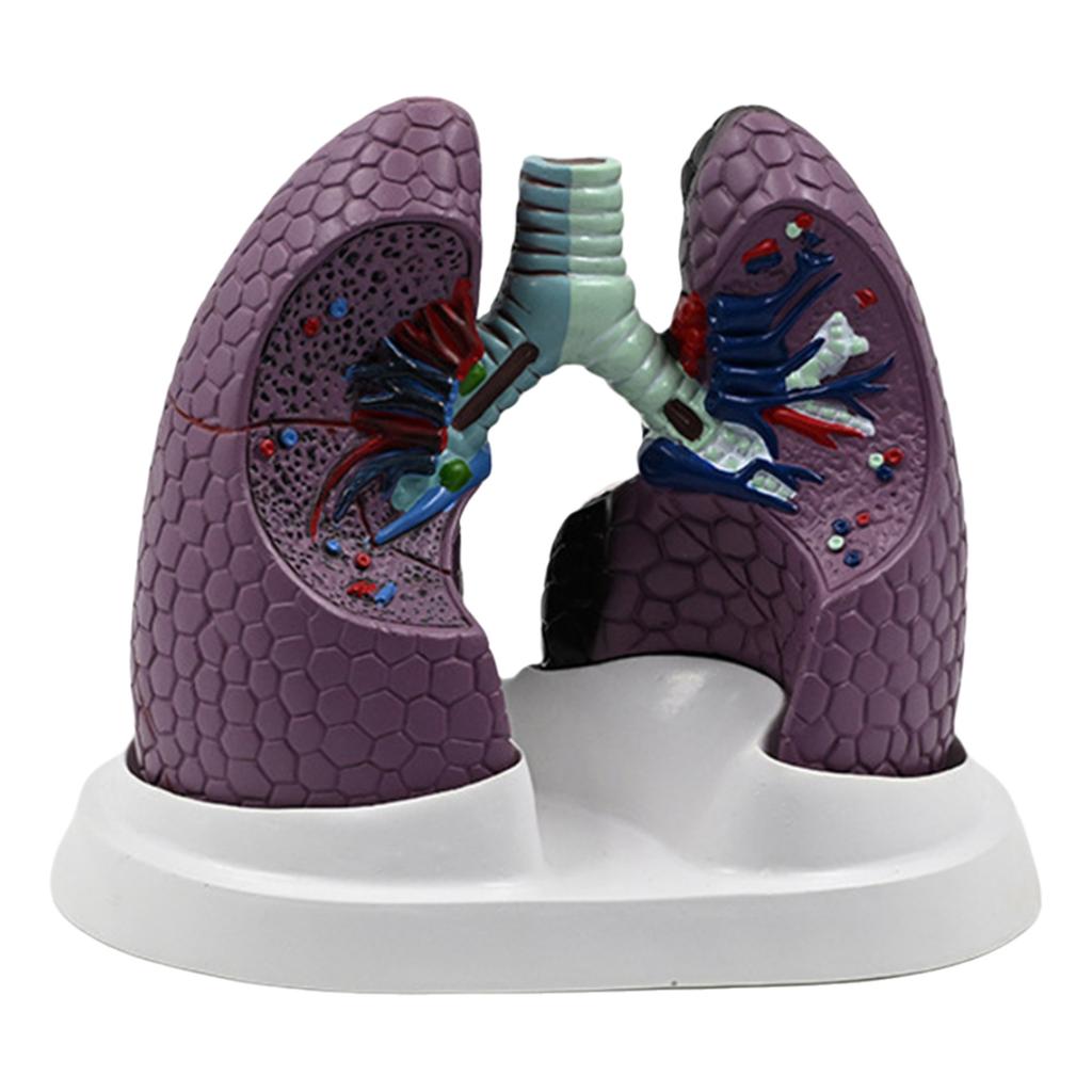 Anatomical Pathological Lung Model Human Lung Anatomy Model Normal and Pathological Lung Anatomy Model for Teaching Tool