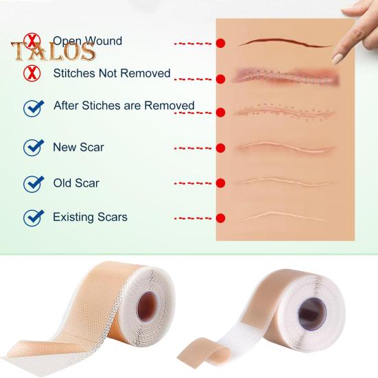 Silikon ärrarkblad Ärrtejp Rulle Professionella Mjuka Ärrremsor för Kirurgiska Ärr Keloider Akneärrbehandling Silikongelplåster