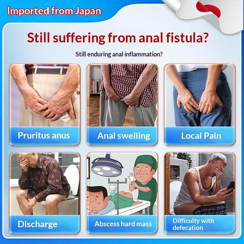 Topical Cream for Anal Fistula Care and Comfort