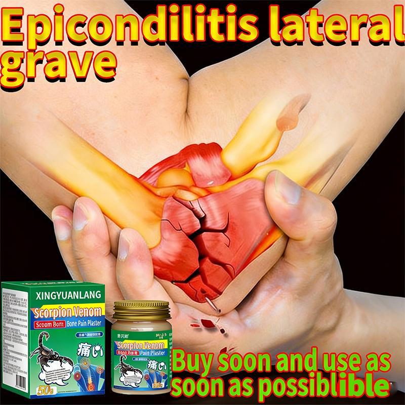 Успокаивающая мазь для локтей - Целенаправленное облегчение при локте теннисиста и раздражении сухожилий