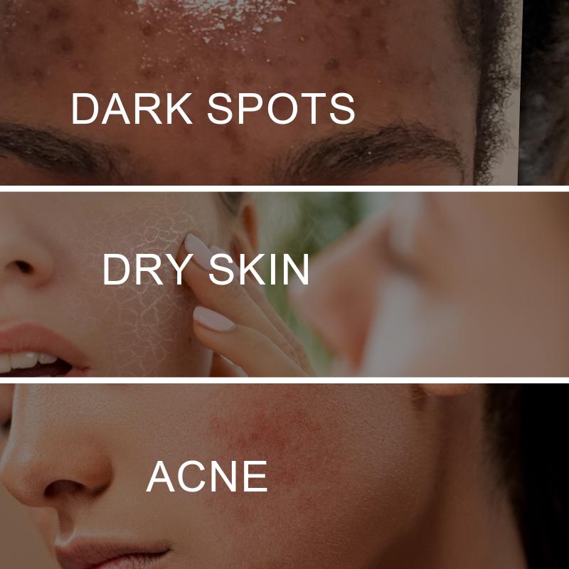 Face Brightening Whitening Cream With Pigment Removal Spot Clearing Repair Roughness Daily Skincare Solution
