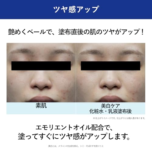 Aqua Label Treatment Lotion (Brightening) Moisturizing 150mL Refill CICA 4MSK Whitening Care Quasi-Drug Released February 2024