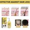 OUHOE Ginger Anti-Hair Loss Shampoo 100ml - Anti-Hair Loss, Strengthens Hair, Removes Dandruff, Controls Oil, and Thickens Hair.