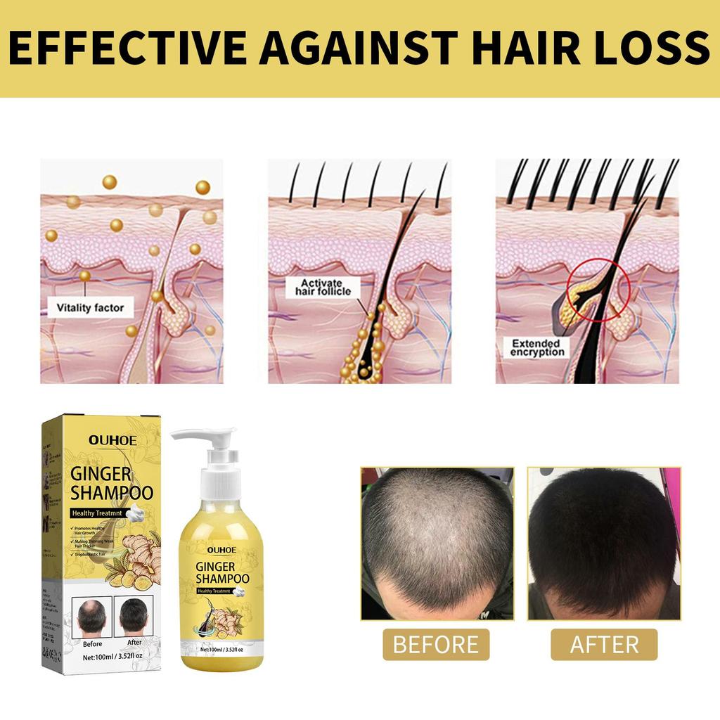 OUHOE Ginger Anti-Hair Loss Shampoo 100ml - Anti-Hair Loss, Strengthens Hair, Removes Dandruff, Controls Oil, and Thickens Hair.