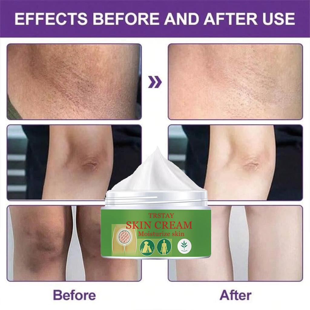 The Skin Cream Moisturizes, Nourishes and Brightens the Skin. Body Lotion To Reduce Skin Dullness and Brighten Skin Cream