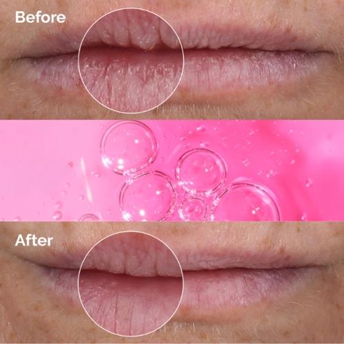 THE ORDINARY PHA 5% Eksfolierende Leppeserum 15ml