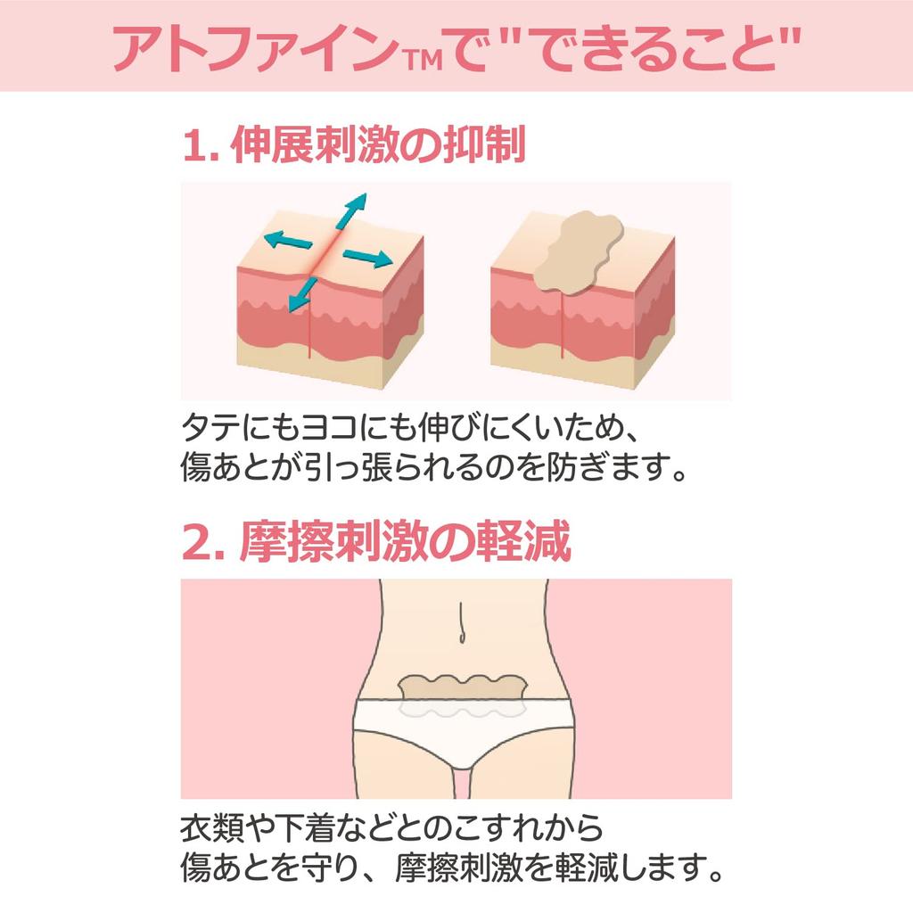 Nichiban Atofine Medium 50mm x 6 ATFM Paper, Size, 114mm, Sheets,