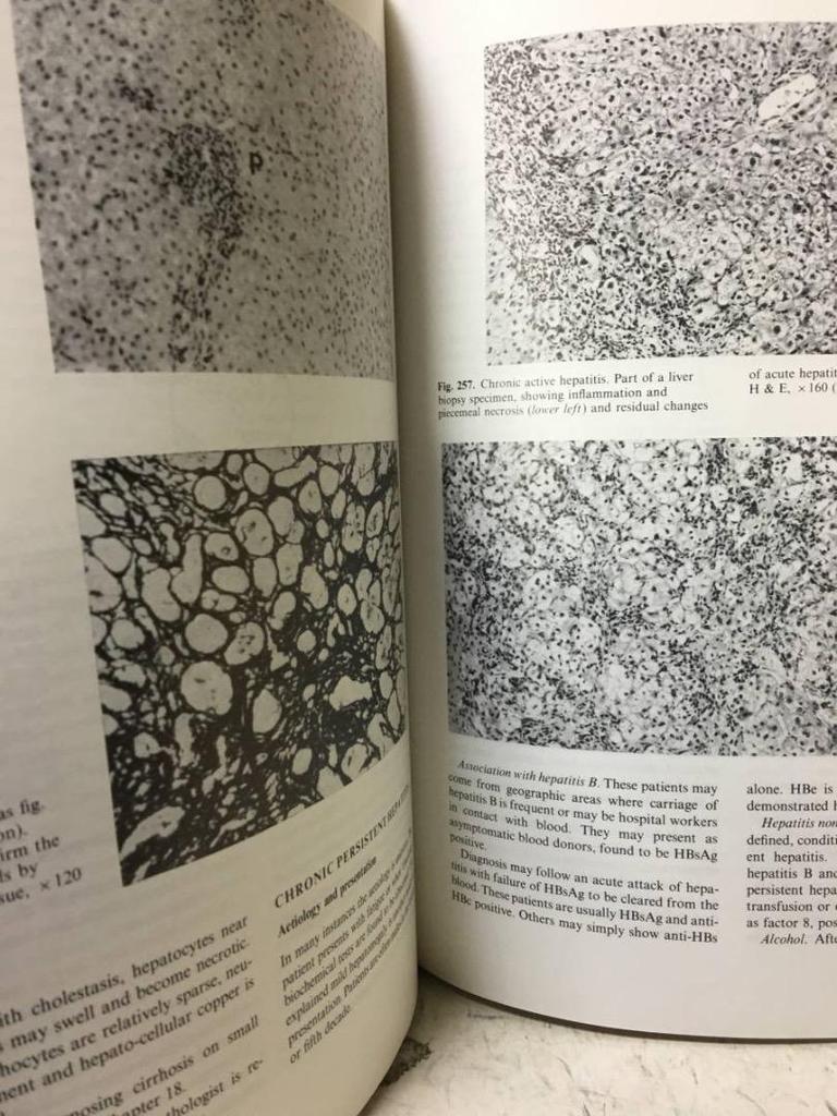 [USED] Diseases of the Liver and Biliary Medical Books