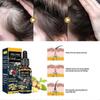 Ginger Germinal Oil Plant Essential Oil Hair Nutrient Solution Hair Growth Essence Liquid