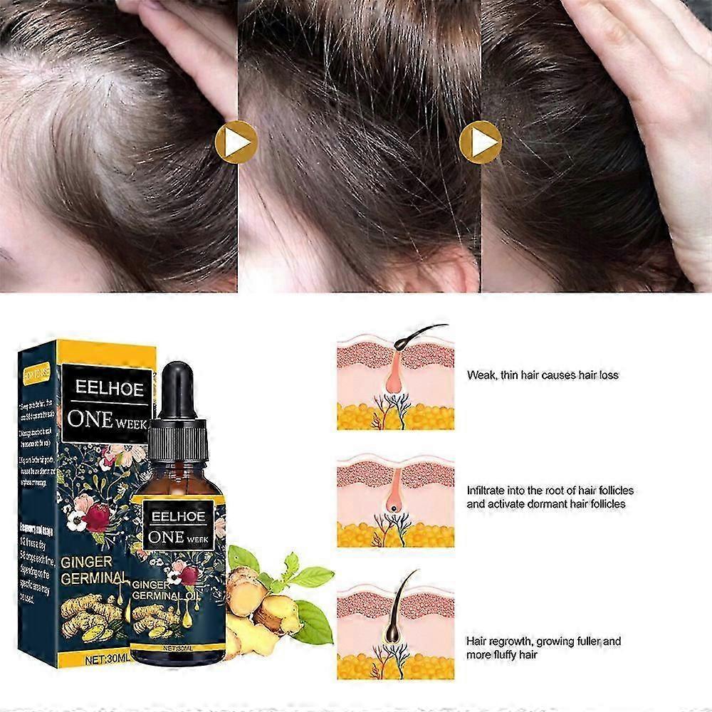Ginger Germinal Oil Plant Essential Oil Hair Nutrient Solution Hair Growth Essence Liquid