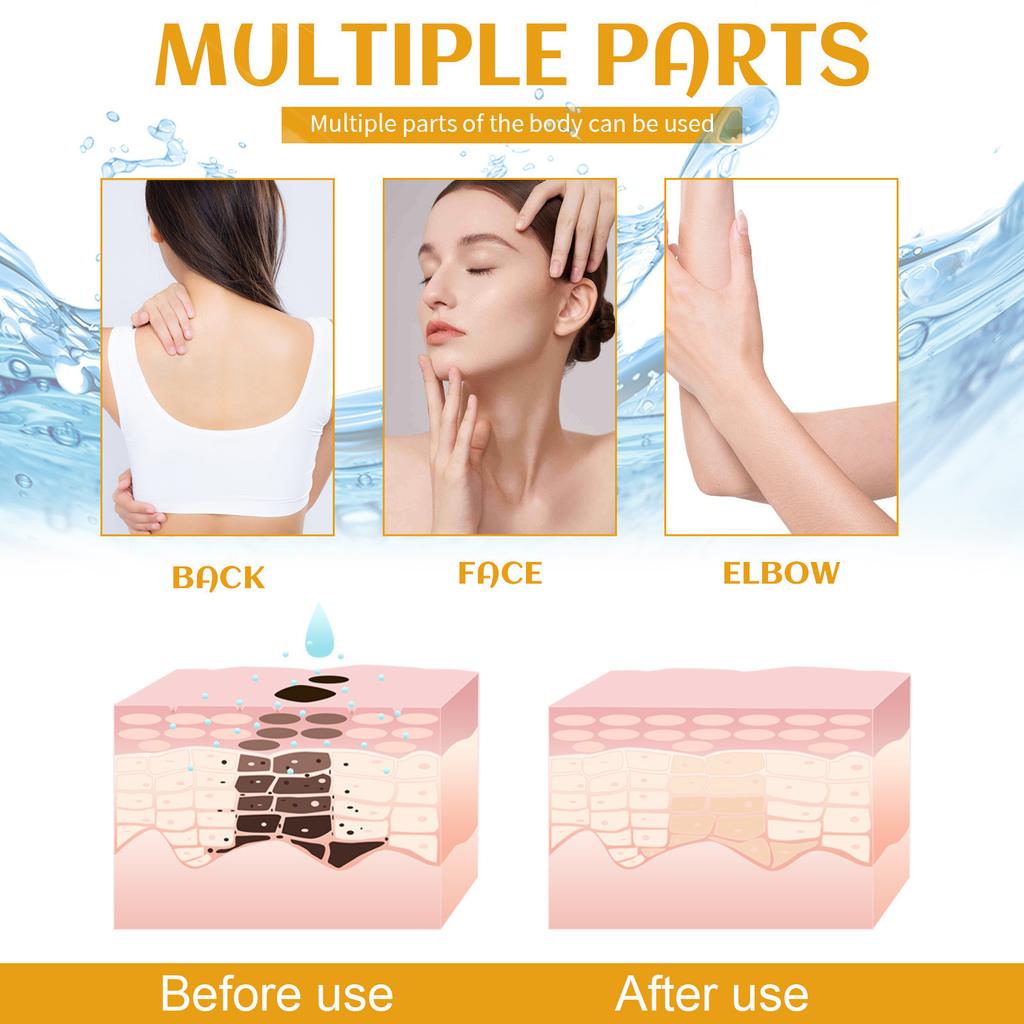 Hautaufhellung für die Achseln, Hautaufhellung für Gesicht und Körper, Aufhellung für Achseln, Hals, Knie, Ellbogen, 120 ml