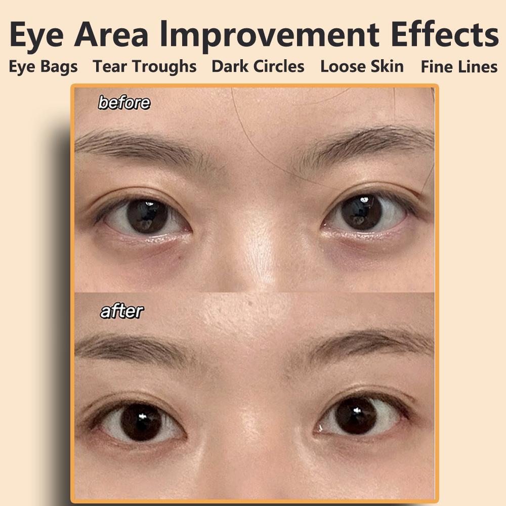 Ems Pulse Micro Current Eye Massage Equipment Eye Massager Reduces Dark Circles, Lifts and Tightens The Skin Face Microcurrent