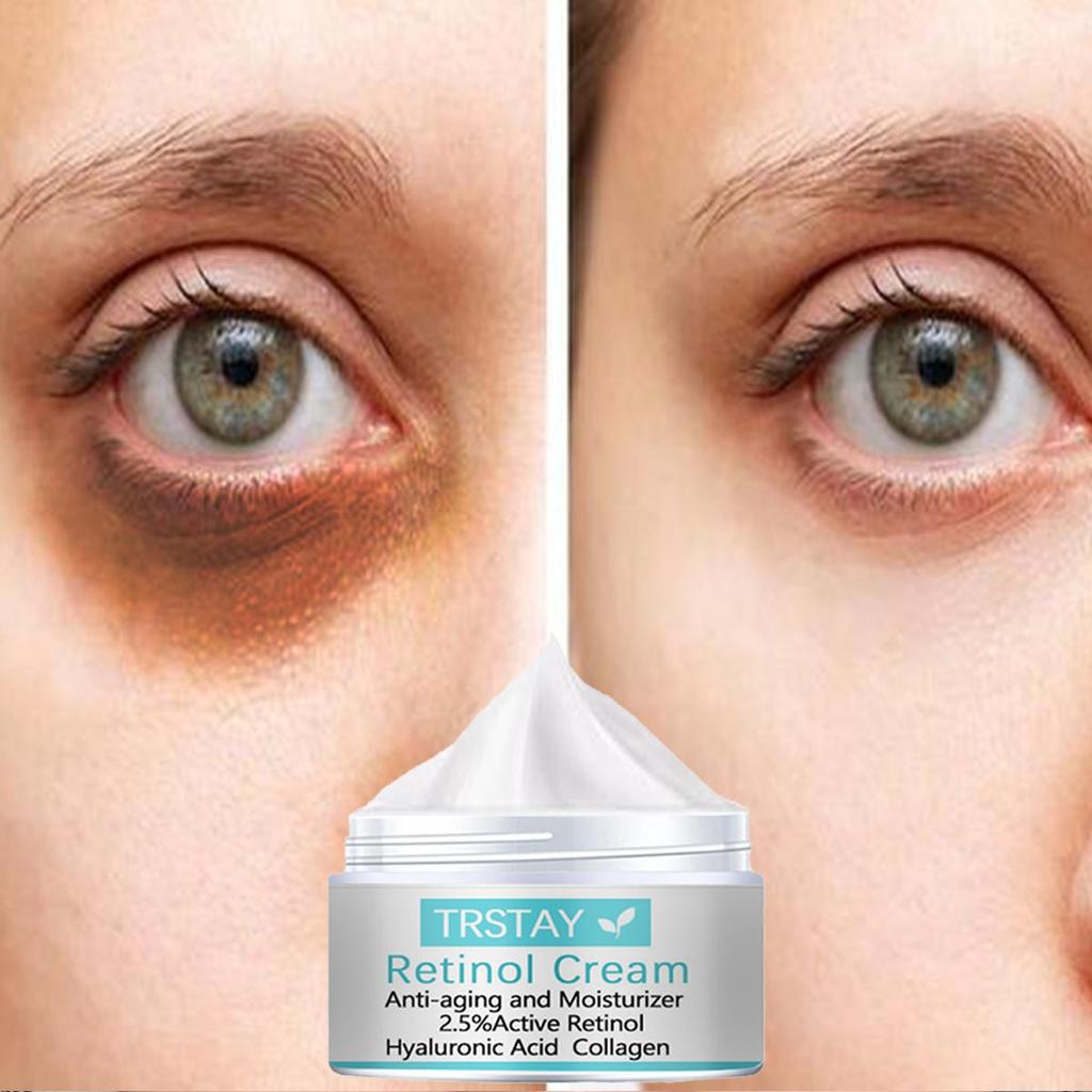 Okamžitě odstranit oční váčky Krém Retinol Krém Gel proti otokům Tmavé kruhy Oddaluje stárnutí vyblednutí vrásek Zpevnění Rozjasnění