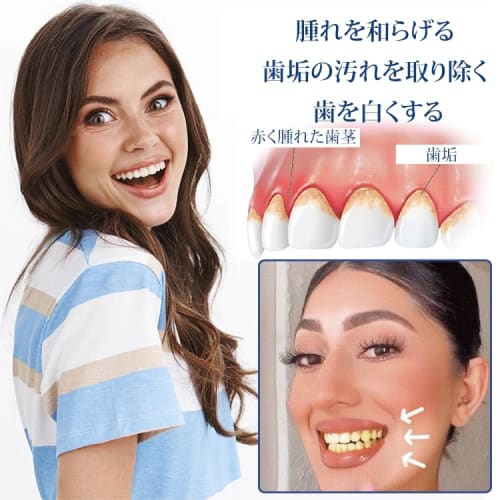 Gum Care Gel, Glossy Whitening Toothpaste Gel, Periodontal Pro Care, Interdental Gel, Gum Therapy Gel for Recessed Gums, Repairs and Protects Gum Tiss