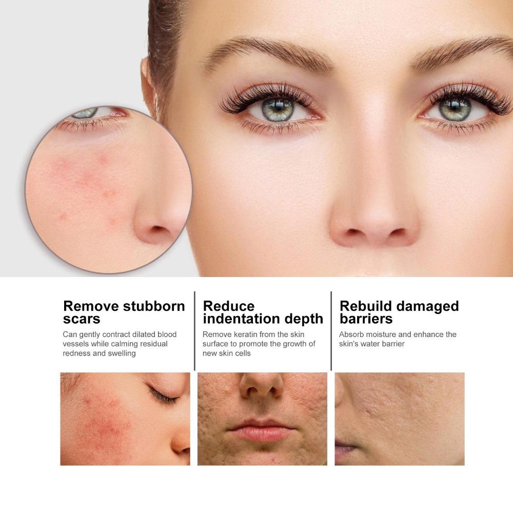 50ML Niacin Facial Essence, Moisturizing and Whitening Skin, Fading Acne Marks and Pores, Shrinking Pores