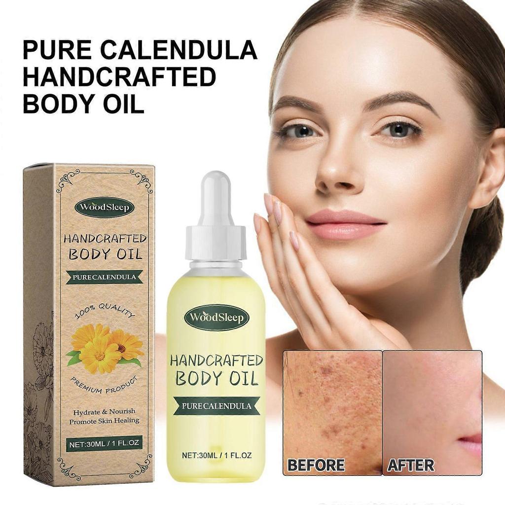 Woodsleep Calendula Care Essential Oil Reduces Scar Skin Redness, Moisturizes, Smooths And Tightens The Skin