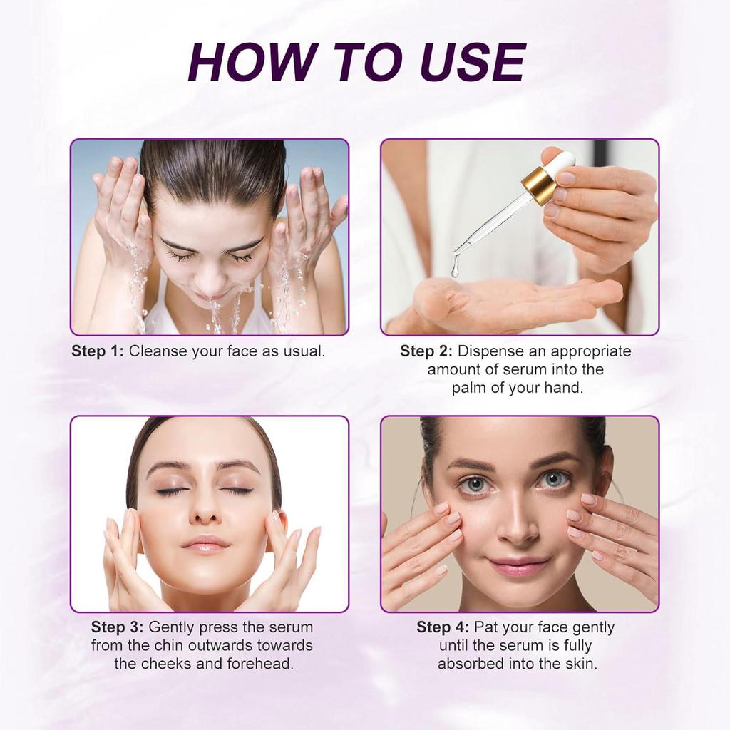 Azelaic Acid Serum-Eliminate Acne And Acne Scars-Inhibit The Growth Of Melanin-Soothing and Repairing Skin-Suitable For All Skin Types, 30ml