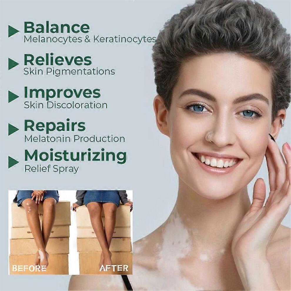 2 uds. Crema Reparadora de Piel para Vitíligo, Crema Tratamiento Vitíligo, Elimina Manchas Blancas en la Piel y Mejora la Pigmentación de la Piel